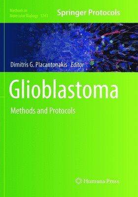 bokomslag Glioblastoma