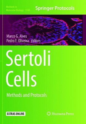 Sertoli Cells 1