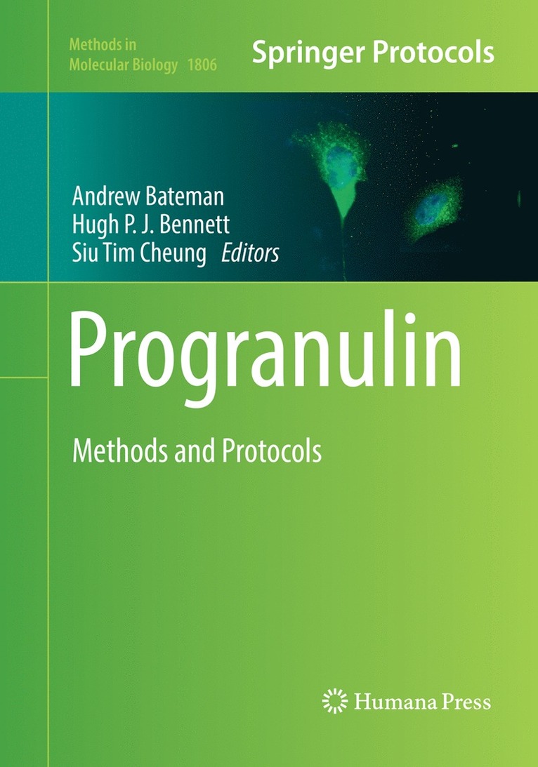 Andrew Bateman, Hugh P.J. Bennett, Siu Tim Cheung, Hugh P. J. Bennett - Progranulin, Häftad