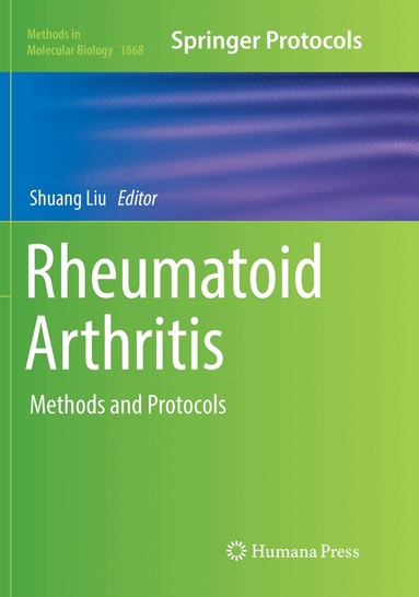 Shuang Liu - Rheumatoid Arthritis, Häftad