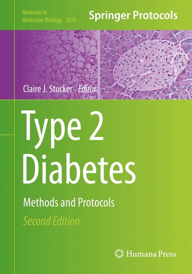 Claire J. Stocker - Type 2 Diabetes, Inbunden