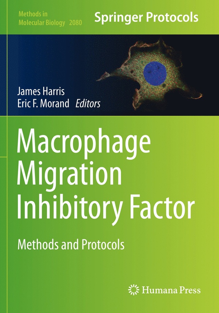 Macrophage Migration Inhibitory Factor