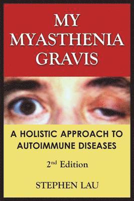 bokomslag My Myasthenia Gravis: A Holistic Approach to Autoimmune Diseases