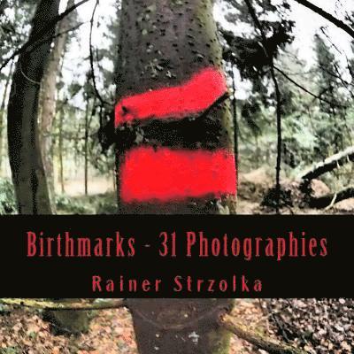 Birthmarks - 31 Photographies 1