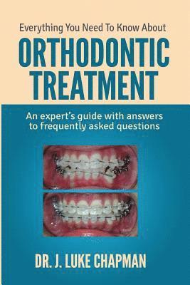 J. Luke Chapman - Everything You Need To Know About Orthodontic Treatment: An expert's guide with answers to frequently asked questions, Häftad