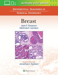 bokomslag Differential Diagnoses in Surgical Pathology: Breast