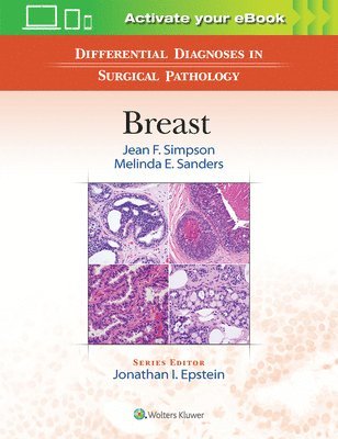 bokomslag Differential Diagnoses in Surgical Pathology: Breast
