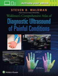 bokomslag Waldman's Comprehensive Atlas of Diagnostic Ultrasound of Painful Conditions