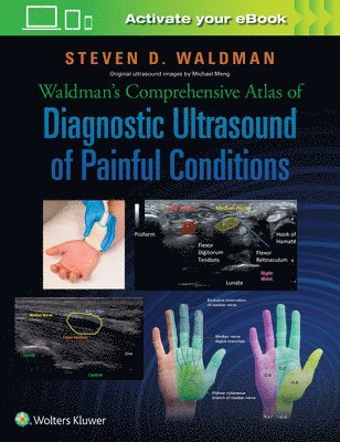 Waldman's Comprehensive Atlas of Diagnostic Ultrasound of Painful Conditions 1