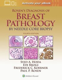 bokomslag Rosen's Diagnosis of Breast Pathology by Needle Core Biopsy