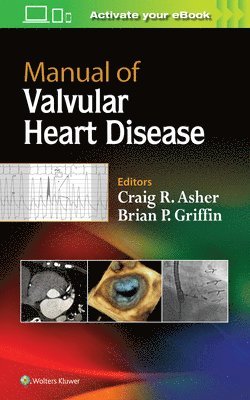 Craig R. Asher, Brian P. Griffin - Manual of Valvular Heart Disease, Häftad