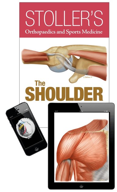 David W. Stoller - Stoller's Orthopaedics and Sports Medicine: The Shoulder Package, Inbunden