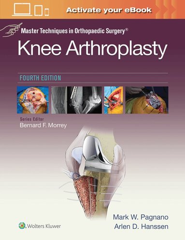 Mark W. Pagnano - Master Techniques in Orthopedic Surgery: Knee Arthroplasty, Inbunden