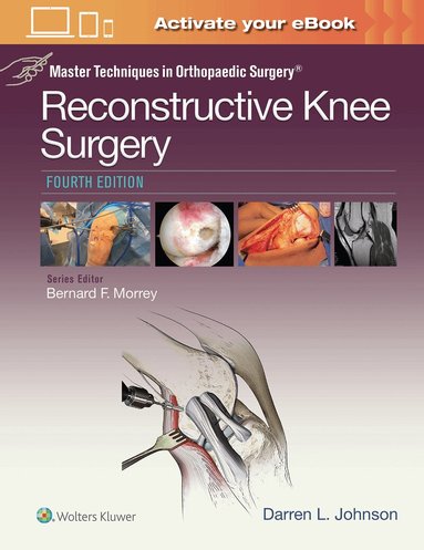 Darren L. Johnson - Master Techniques in Orthopaedic Surgery: Reconstructive Knee Surgery, Inbunden