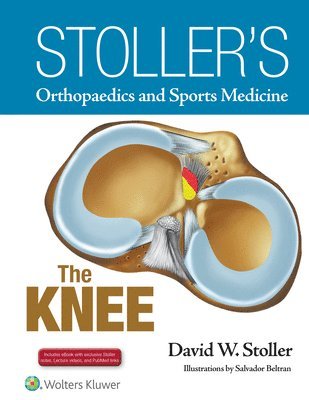 Stoller's Orthopaedics and Sports Medicine: The Knee 1
