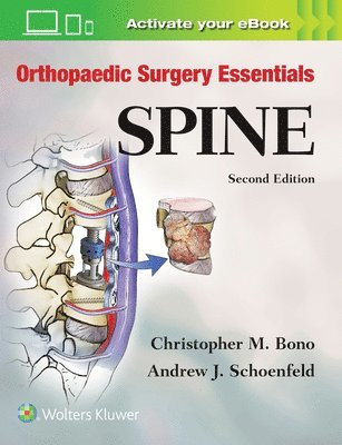 Orthopaedic Surgery Essentials: Spine 1
