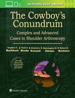 The Cowboy's Conundrum: Complex and Advanced Cases in Shoulder Arthroscopy 1