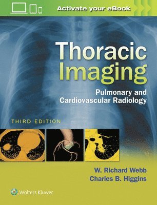 Thoracic Imaging 1