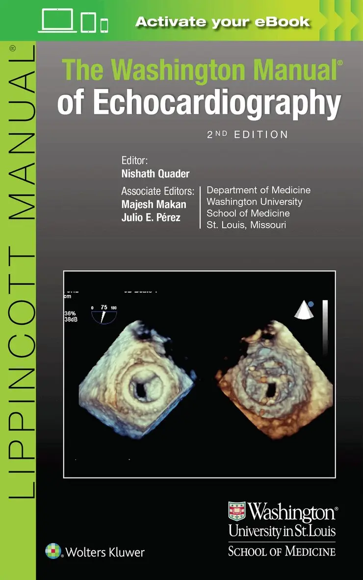 Nishath Quader, Majesh Makan, Julio Perez - Washington Manual of Echocardiography, Häftad. Tillgänglighet: Lägg i varukorg