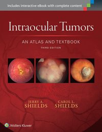 bokomslag Intraocular Tumors: An Atlas and Textbook