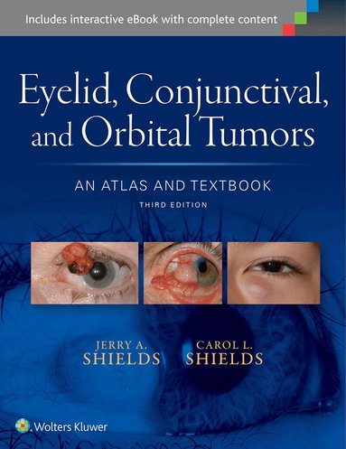 Jerry A. Shields, Carol L. Shields - Eyelid, Conjunctival, and Orbital Tumors: An Atlas and Textbook, Inbunden