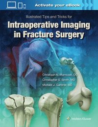 bokomslag Illustrated Tips and Tricks for Intraoperative Imaging in Fracture Surgery