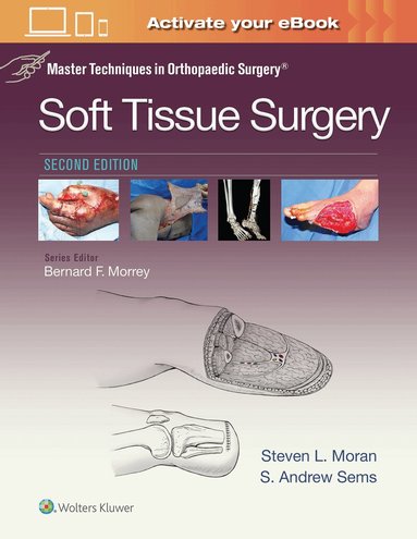 Steven Moran - Master Techniques in Orthopaedic Surgery: Soft Tissue Surgery, Inbunden