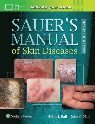 Sauer's Manual of Skin Diseases 1