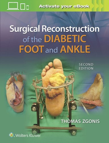 bokomslag Surgical Reconstruction of the Diabetic Foot and Ankle