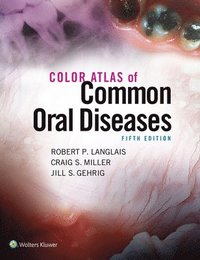 bokomslag Color Atlas of Common Oral Diseases