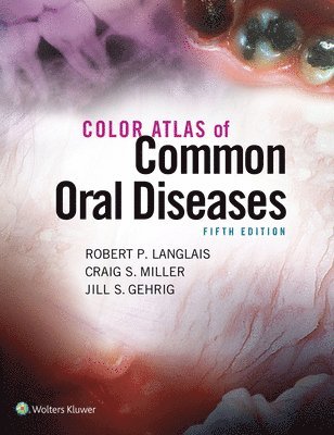 Color Atlas of Common Oral Diseases 1