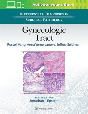bokomslag Differential Diagnoses in Surgical Pathology: Gynecologic Tract