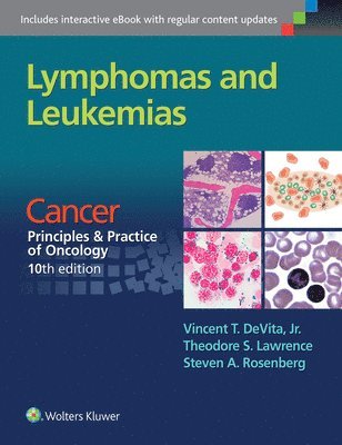 Vincent T. Devita, Theodore S. Lawrence, Steven A. Rosenberg - Lymphomas and Leukemias, Häftad