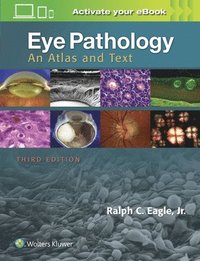 bokomslag Eye Pathology