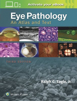 Eye Pathology 1