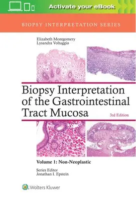 Elizabeth A. Montgomery, Lysandra Voltaggio - Biopsy Interpretation of the Gastrointestinal Tract Mucosa: Volume 1: Non-Neoplastic, Inbunden. Tillgänglighet: Lägg i varukorg