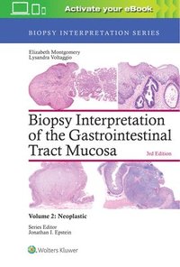 bokomslag Biopsy Interpretation of the Gastrointestinal Tract Mucosa: Volume 2: Neoplastic