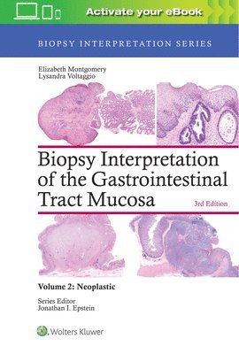 Elizabeth A. Montgomery, Lysandra Voltaggio - Biopsy Interpretation of the Gastrointestinal Tract Mucosa: Volume 2: Neoplastic, Inbunden. Tillgänglighet: Lägg i varukorg