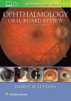 Ophthalmology Oral Board Review 1