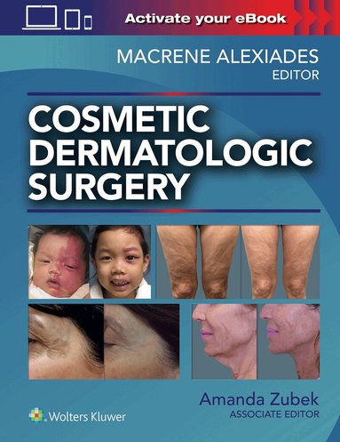 Macrene Alexiades, Amanda Zubek - Cosmetic Dermatologic Surgery, Inbunden