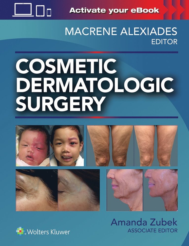Macrene Alexiades, Amanda Zubek, PhD Alexiades, Macrene, MD, PhD Zubek, Amanda, MD - Cosmetic Dermatologic Surgery, Inbunden