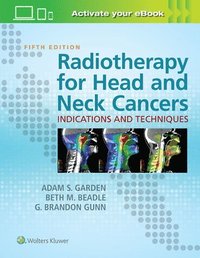 bokomslag Radiotherapy for Head and Neck Cancers