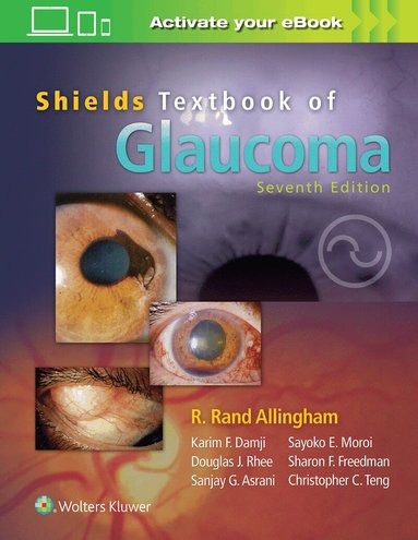 R. Rand Allingham, Sayoko E. Moroi, M. Bruce Shields, Karim F. Damji - Shields' Textbook of Glaucoma, Inbunden