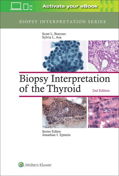 Scott L. Boerner, Sylvia L. Asa - Biopsy Interpretation of the Thyroid, Inbunden