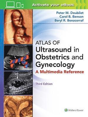 bokomslag Atlas of Ultrasound in Obstetrics and Gynecology