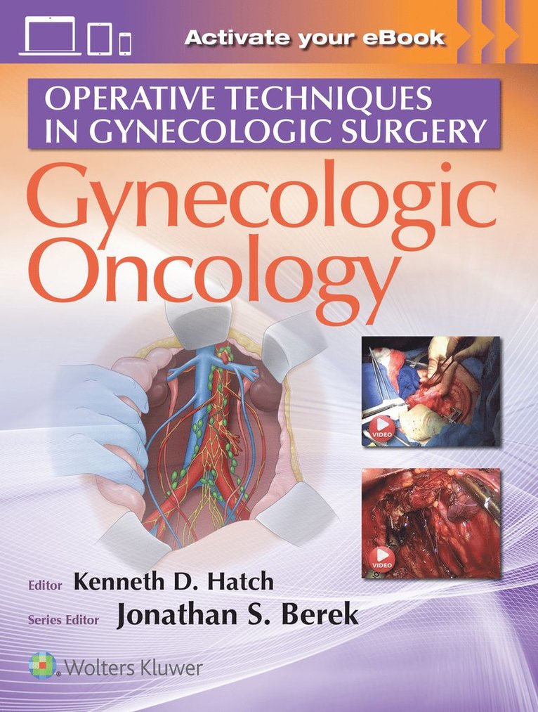 Kenneth D Hatch, MD Hatch, Kenneth D, Kenneth D. Hatch, Jonathan S. Berek - Operative Techniques in Gynecologic Surgery, Inbunden