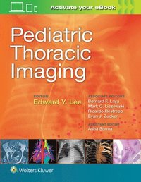 bokomslag Pediatric Thoracic Imaging
