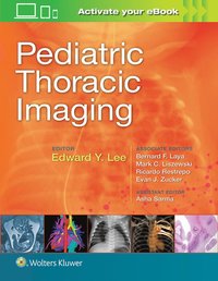 bokomslag Pediatric Thoracic Imaging