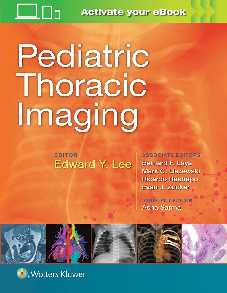 Edward Y. Lee - Pediatric Thoracic Imaging, Inbunden