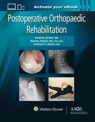 Postoperative Orthopaedic Rehabilitation: Print + Ebook 1